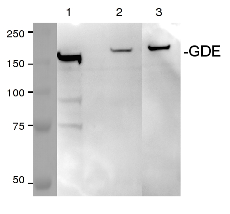 western blot using anti-GDE antibodies